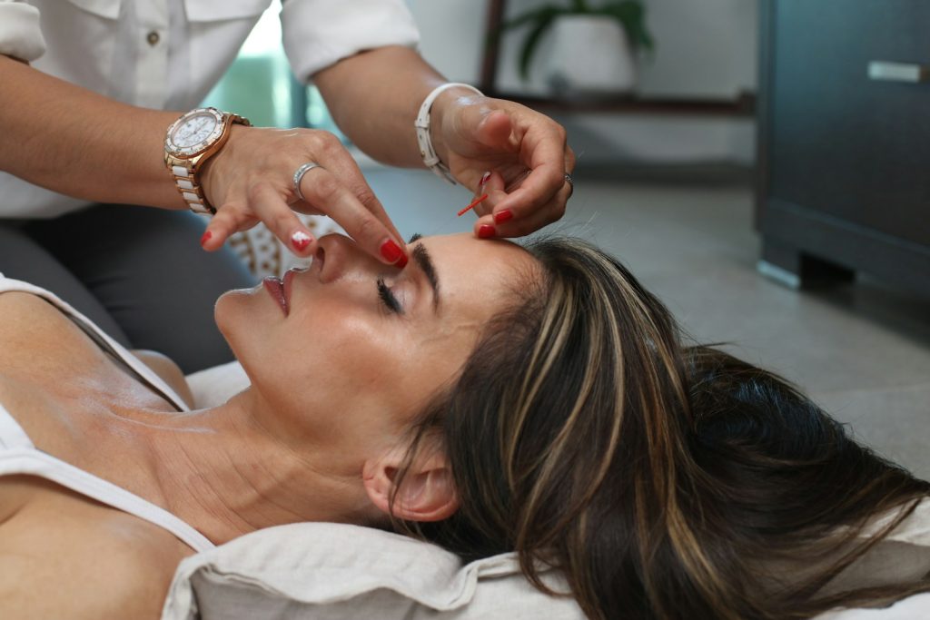 Woman receiving acupuncture treatment on forehead for relaxation and wellness therapy in a calming environment
